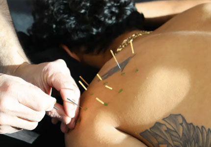Trigger Point Therapy